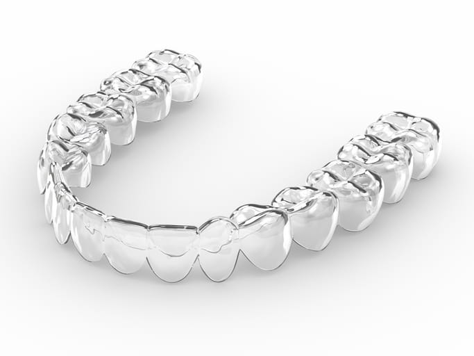 Essix Retainer